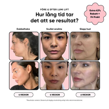 Lumi Lift